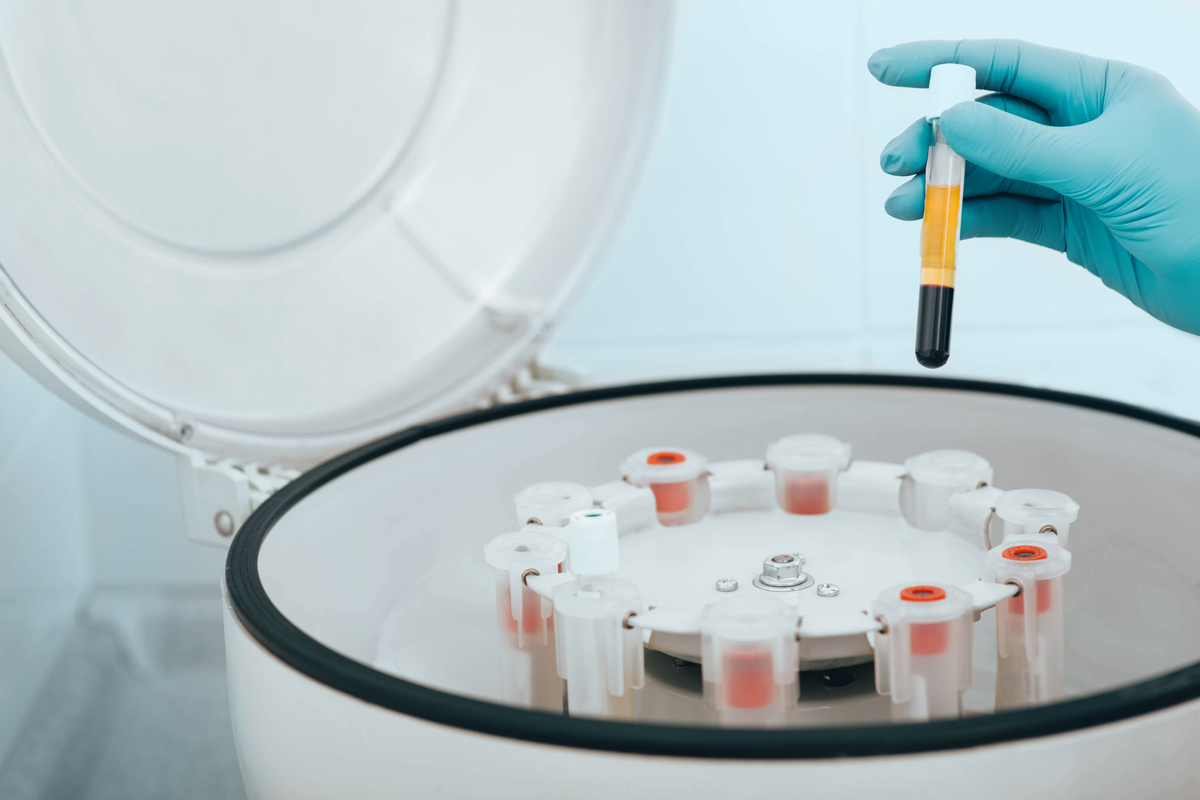 embryo and egg freezing process